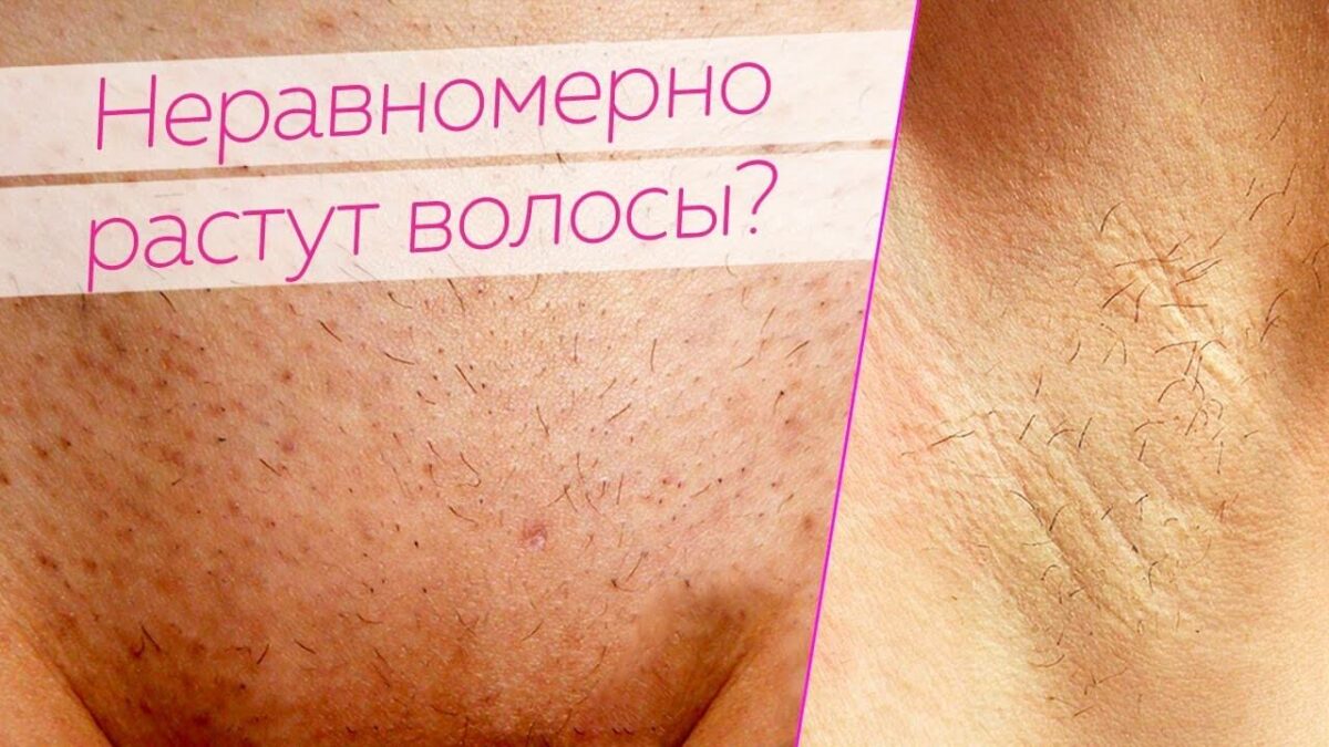 Три фазы роста волос