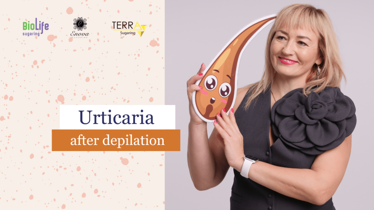 Urticaria after depilation on a client