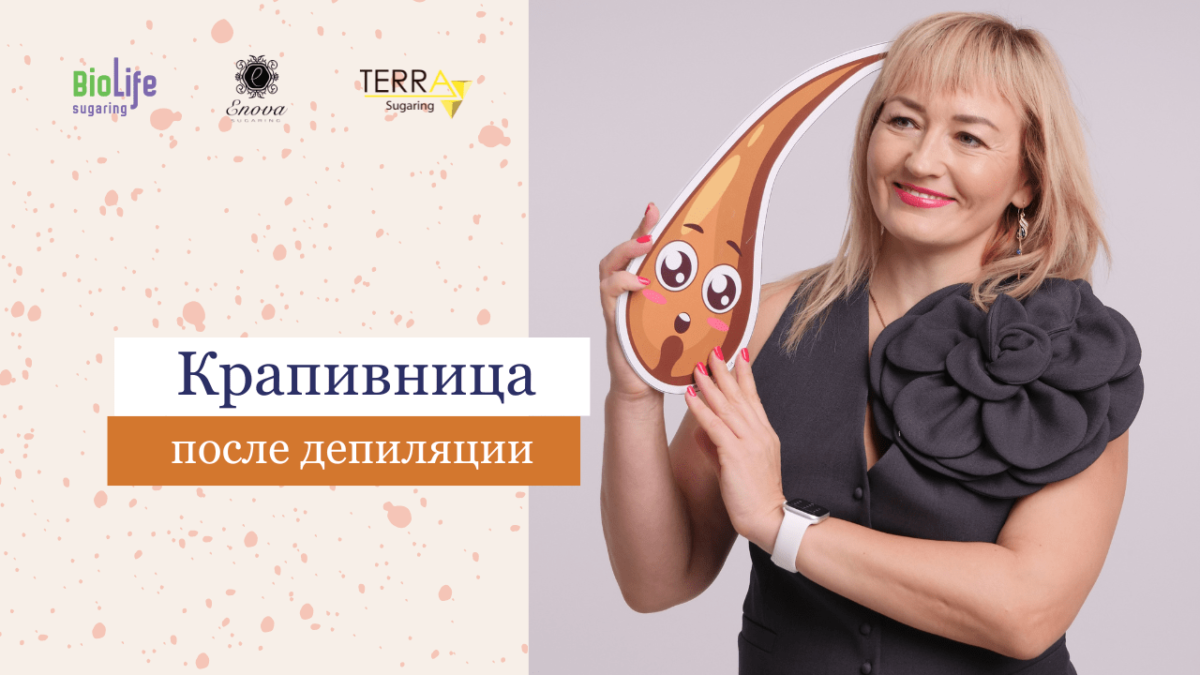 Крапивница после шугаринга